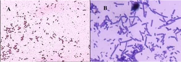 細(xì)菌在顯微鏡下